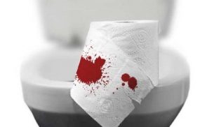 Viêm đại tràng đi ngoài ra máu và cách xử lý
