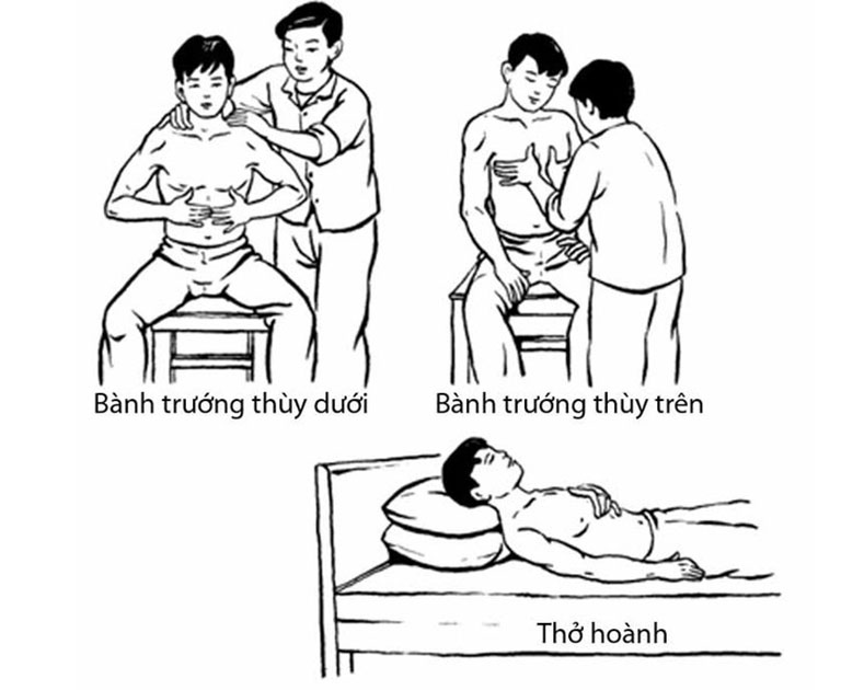 Viêm phế quản mãn tính