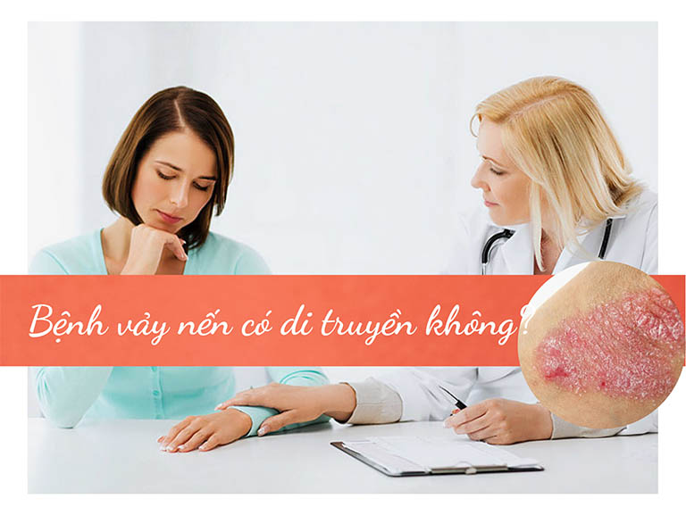 Bệnh vảy nến có di truyền không?