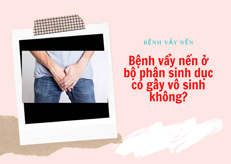 Bệnh vẩy nến ở bộ phận sinh dục có gây vô sinh không