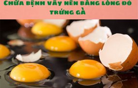 Chữa bệnh vẩy nến bằng lòng đỏ trứng gà