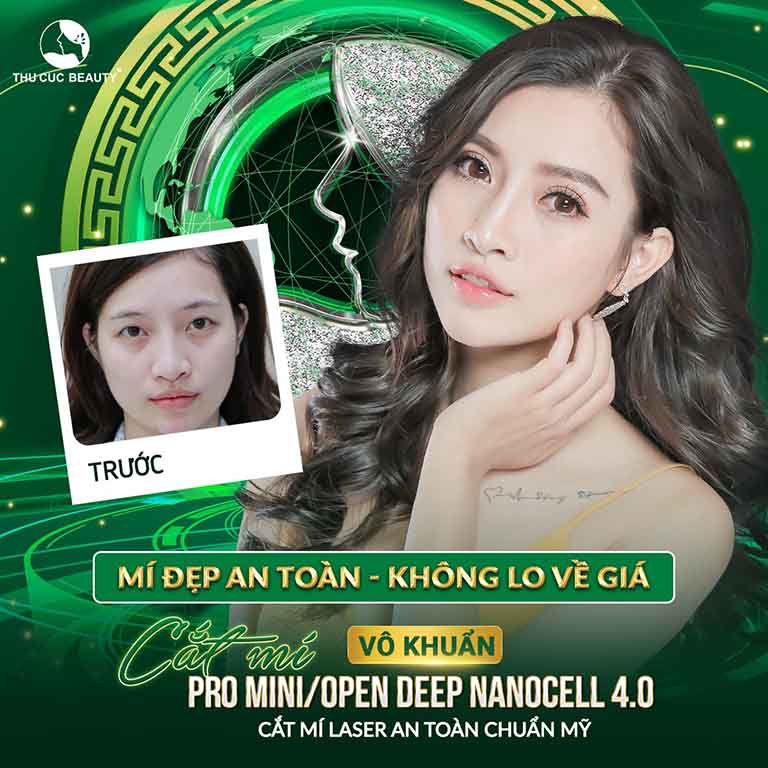 địa chỉ cắt nhấn mí mắt đẹp ở Hà Nội