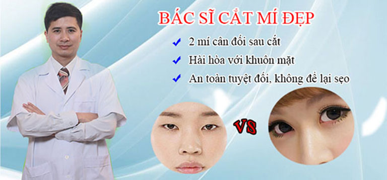 địa chỉ cắt nhấn mí mắt đẹp ở Hà Nội
