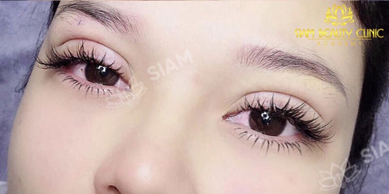 địa chỉ cắt nhấn mí mắt đẹp ở Hà Nội