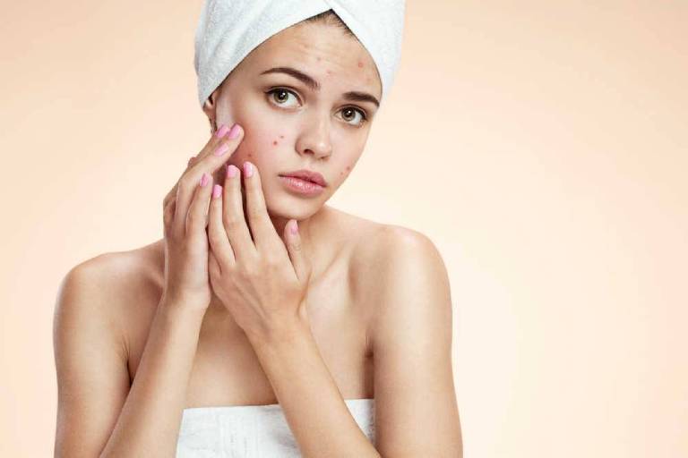 Tình trạng da mặt đột nhiên nổi nhiều mụn có thể do nhiều nguyên nhân gây ra