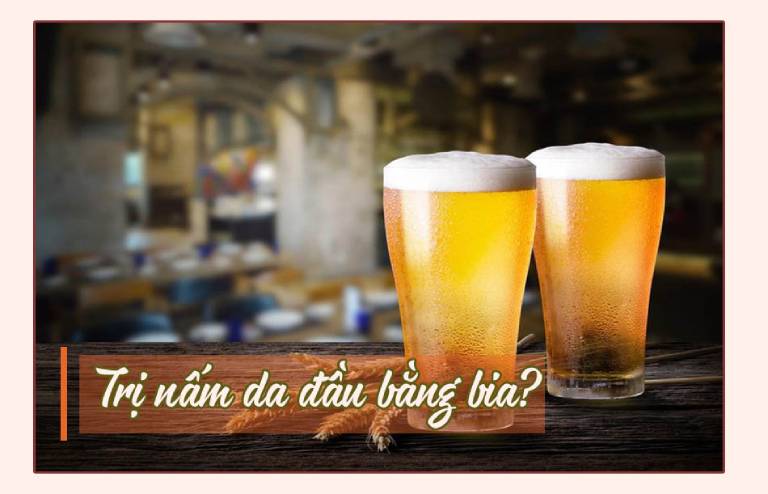 Trị nấm da đầu bằng bia là một trong những phương pháp điều trị tại nhà được nhiều người biết đến