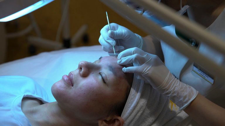 Top 10 trung tâm spa trị mụn ở Đà Nẵng uy tín, đáng tin cậy