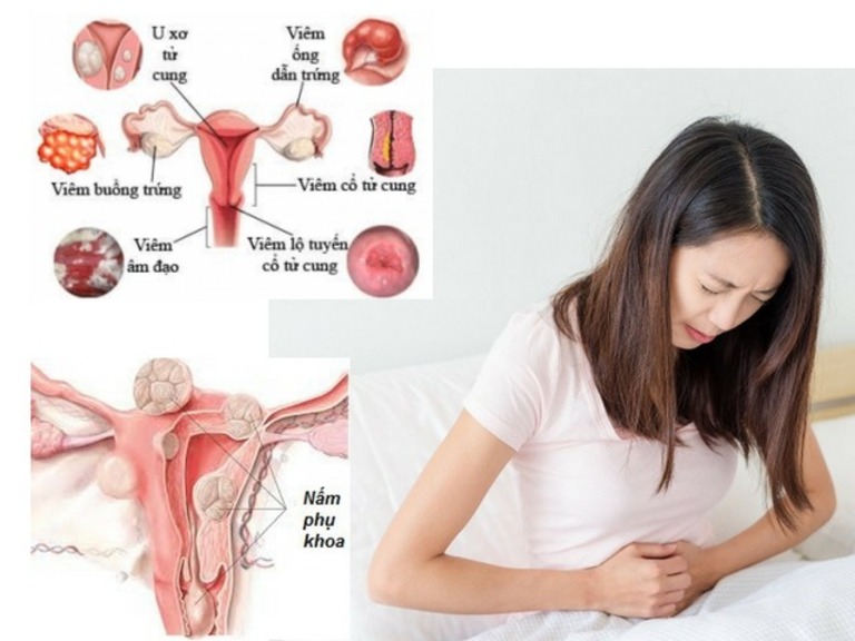 Viêm âm đạo do nấm có nguy hiểm không