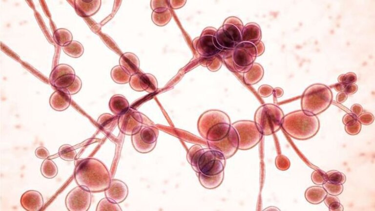 Viêm âm đạo do nấm Candida gây ra