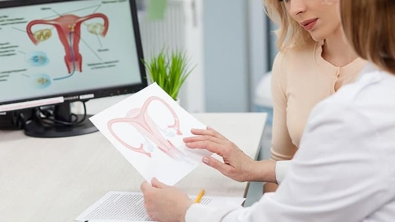 Mổ u xơ tử cung bằng phương pháp nội soi