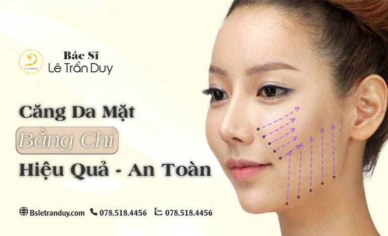 Kinh nghiệm căng da bằng chỉ