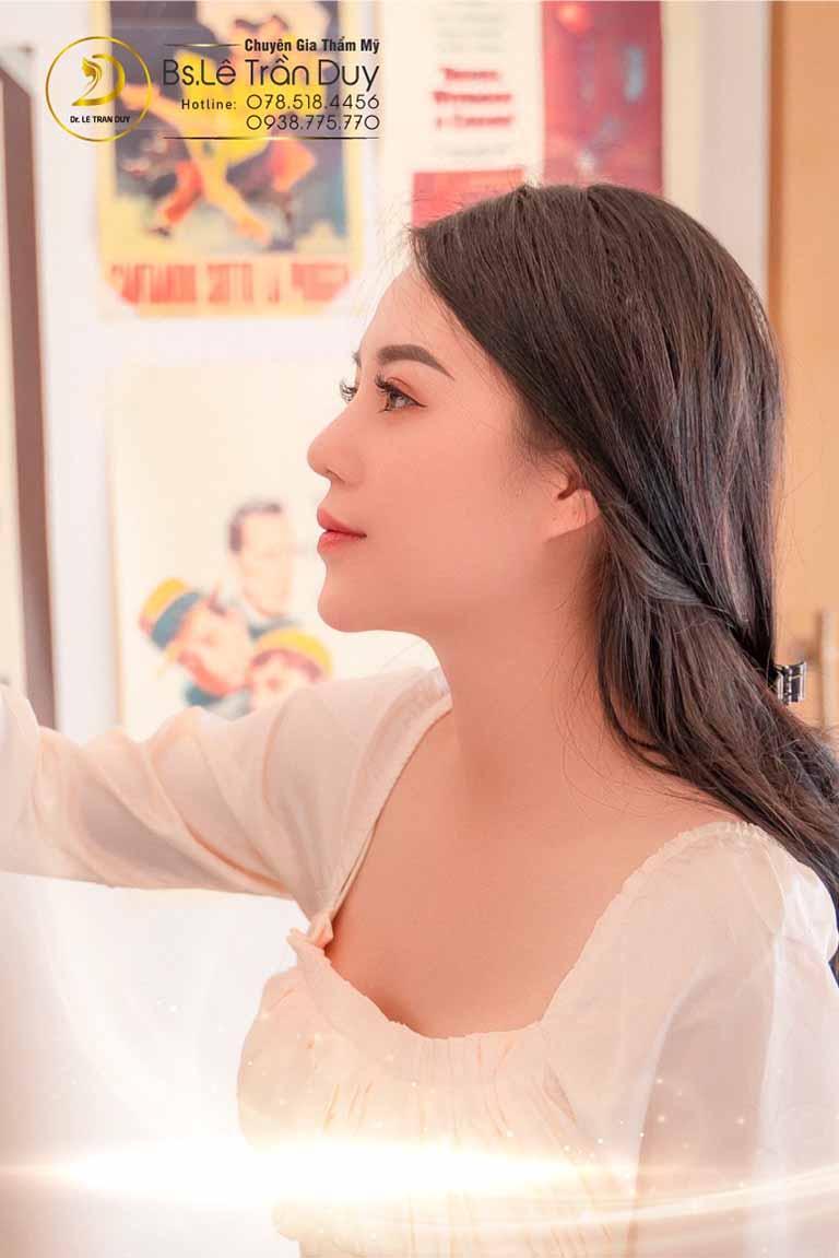 Nâng mũi L line cao tây ở đâu đẹp tại HCM?