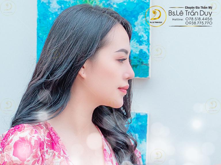 Bác sĩ giỏi nâng mũi tự nhiên đẹp