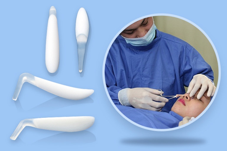 nâng mũi tự nhiên bằng sụn nhân tạo