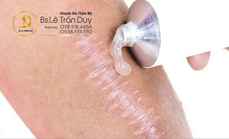cách trị sẹo lồi bằng cách dân gian