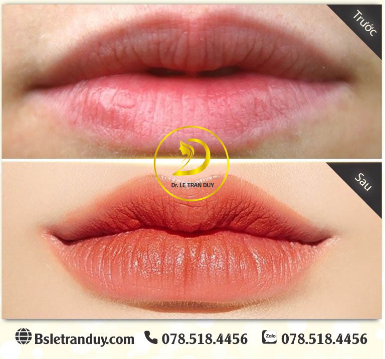 cắt môi trái tim đẹp