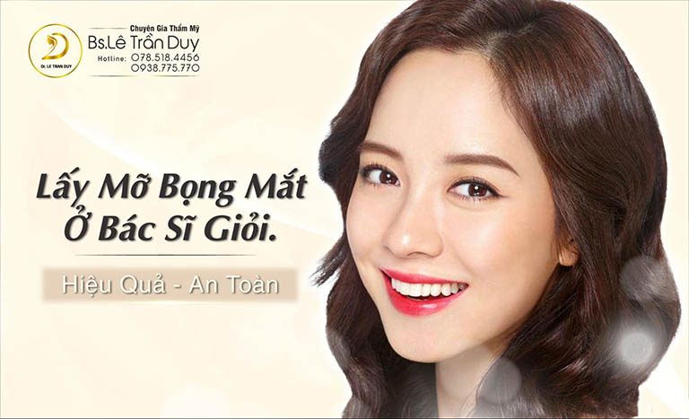 Lấy mỡ bọng mắt trên