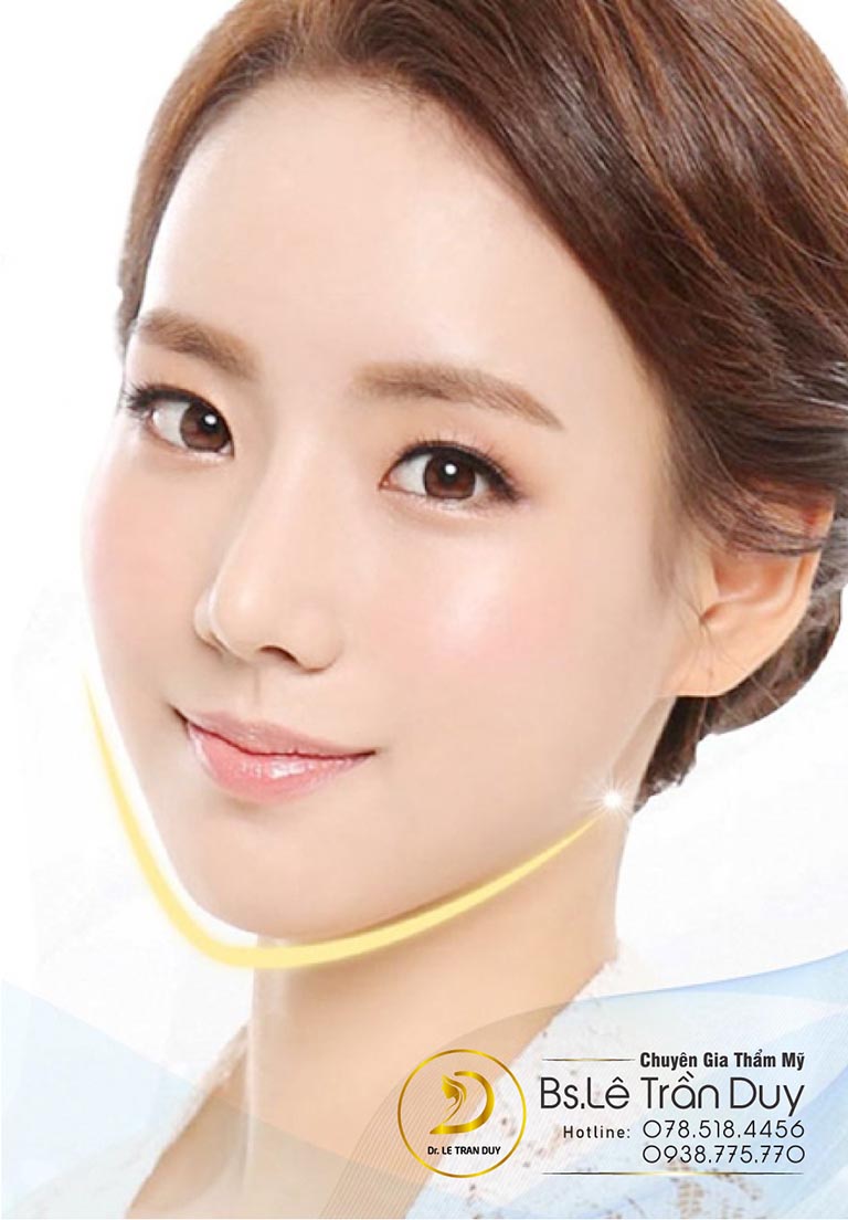 Tiêm filler cằm mang đến chiếc cằm dài đẹp, hài hòa với gương mặt