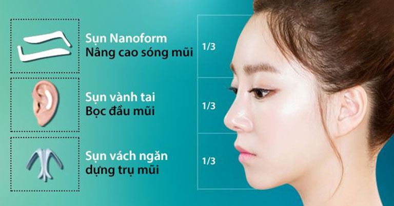 kỹ thuật nâng mũi bằng sụn nanoform