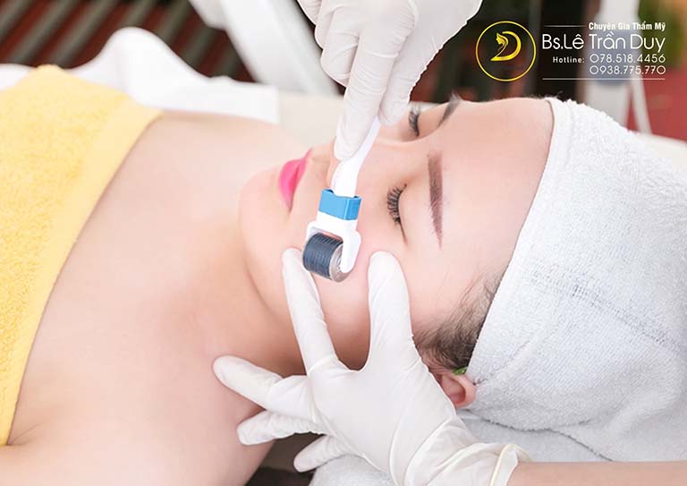 lăn kim ở đâu tốt tphcm