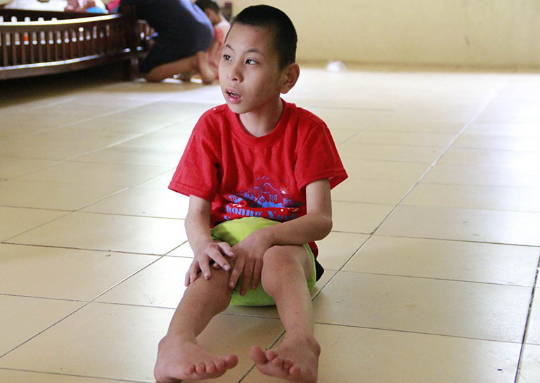 Bại não thể thất điều