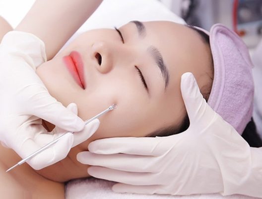địa chỉ lấy nhân mụn uy tín ở Hà Nội