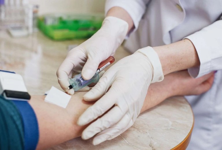 Quá trình xét nghiệm cần được thực hiện bởi những người có chuyên môn