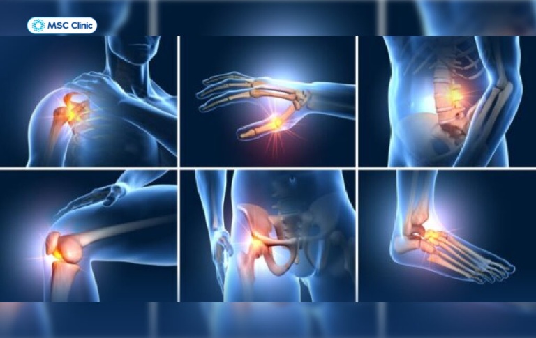 ĐỊA CHỈ KHÁM CƠ XƯƠNG KHỚP UY TÍN HÀNG ĐẦU TẠI HÀ NỘI