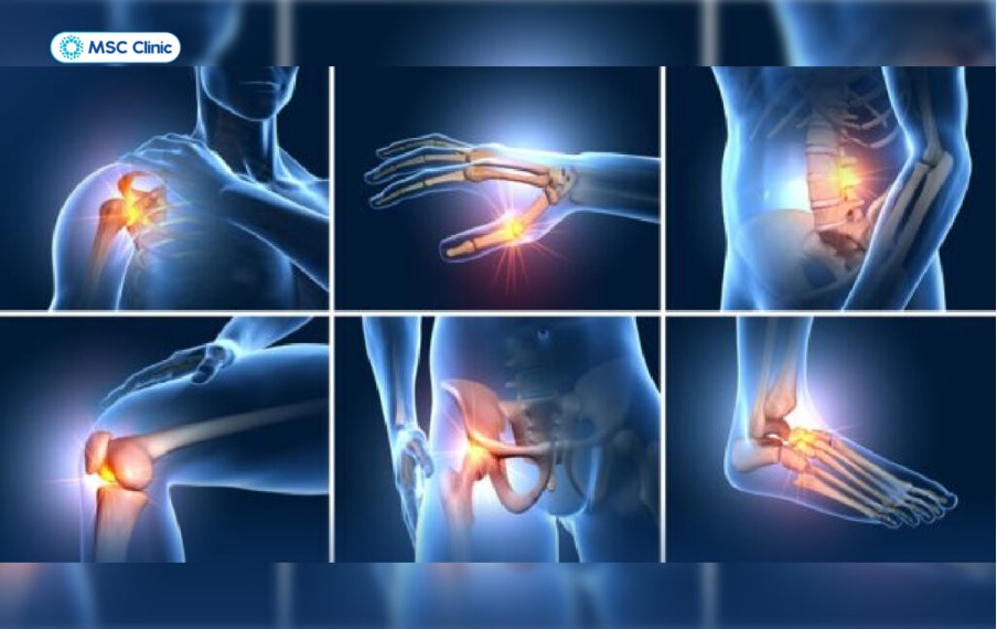 PHÒNG KHÁM ĐA KHOA MSC – ĐỊA CHỈ KHÁM CƠ XƯƠNG KHỚP UY TÍN HÀNG ĐẦU TẠI HÀ NỘI