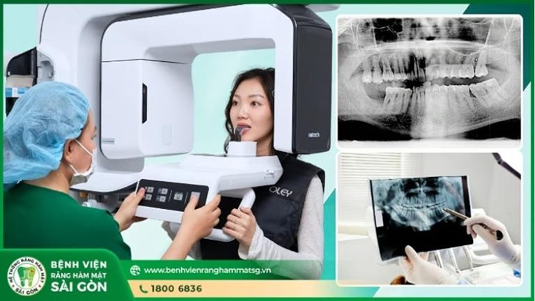 Bệnh viện răng hàm mặt sài gòn